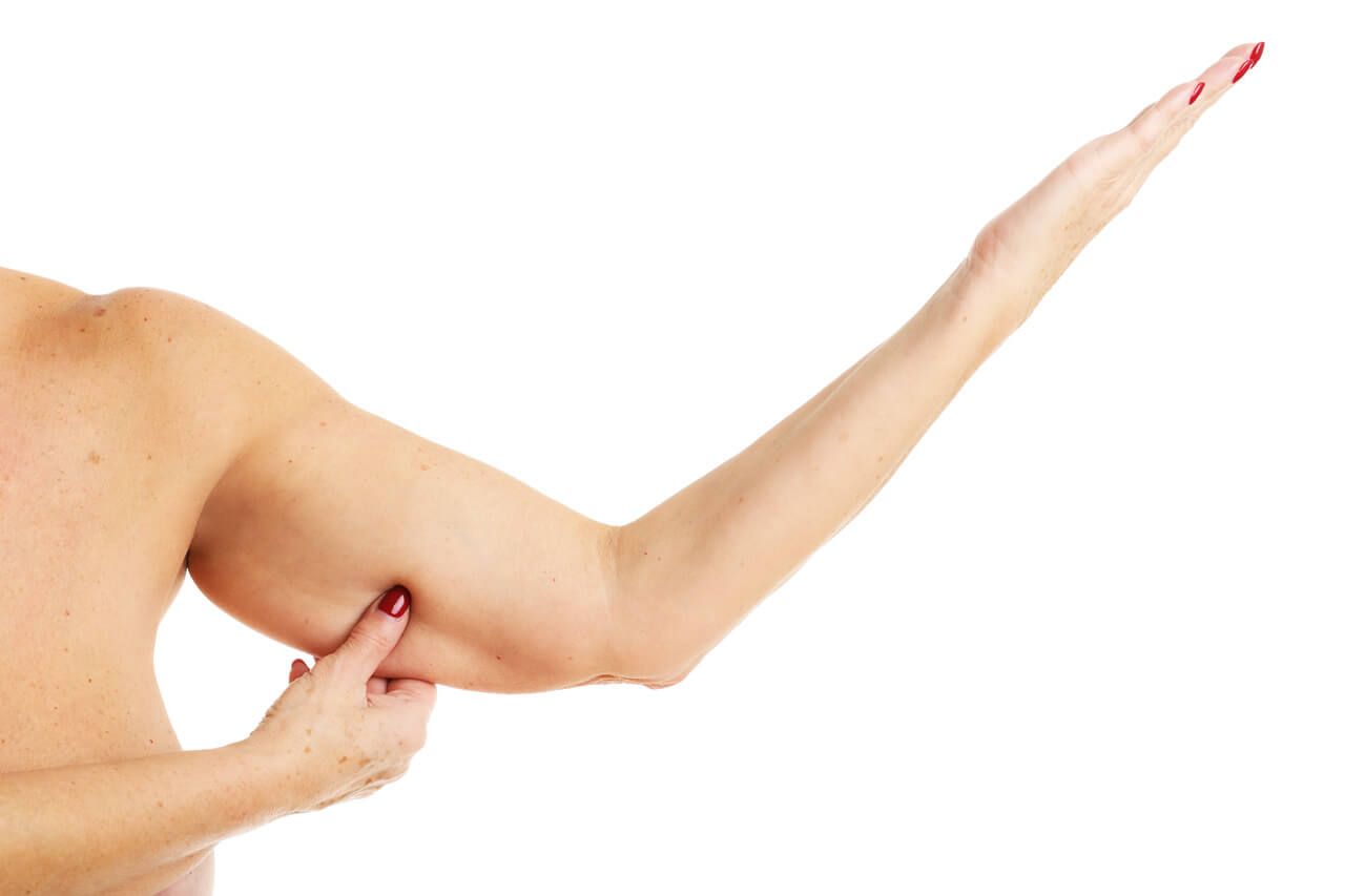 Laser Lésions Pigmentaires